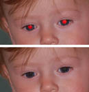 ojos rojos